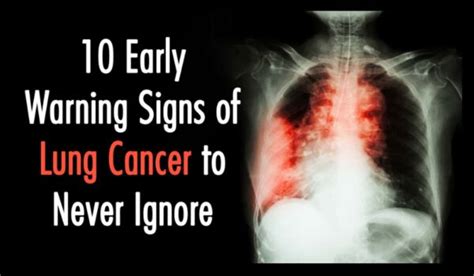 10 Early Warning Signs of Lung Cancer You Need to Know!