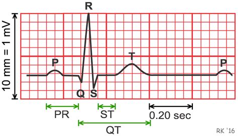 CV Physiology | Electrocardiogram (EKG, ECG)