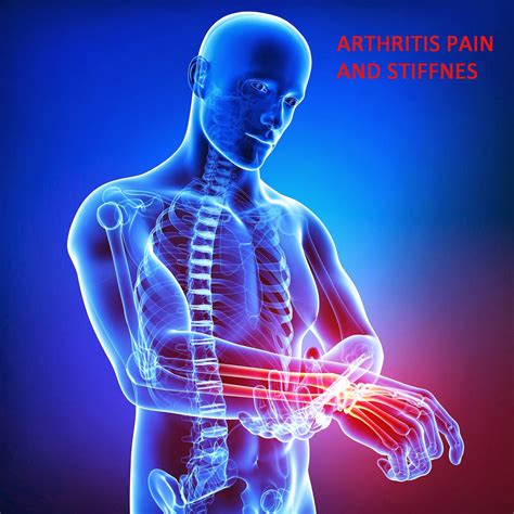 Arthritis Pain - Photos