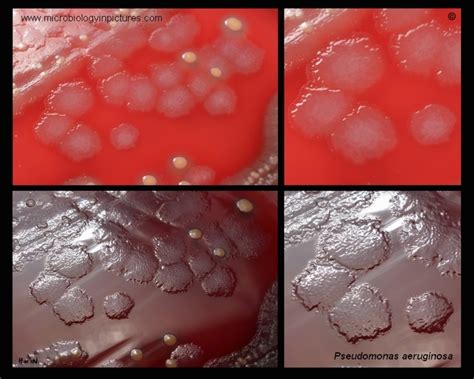 Colony morphology of Pseudomonas aeruginosa cultivated on blood agar. Appearance and morphology ...