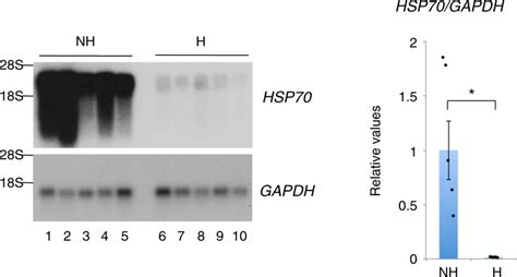 Hibernation-associated gene regulation of the HSP70 gene. The HSP70 and... | Download Scientific ...