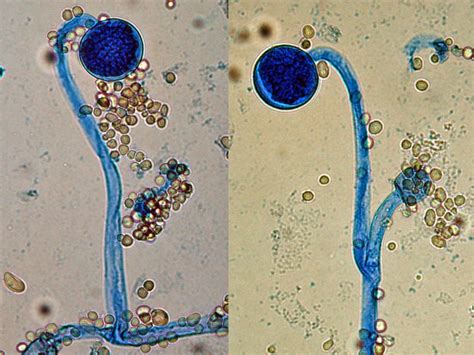 Mucor | Mycology | University of Adelaide