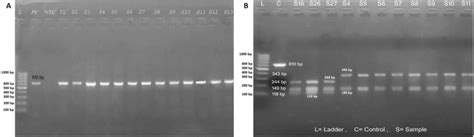 A Visualization of gyrA gene (610 bp) under UV transilluminator after... | Download Scientific ...