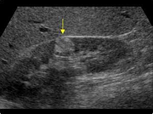 Urinary Tract and male reproductive system | 2.1 Kidney and ureter ...