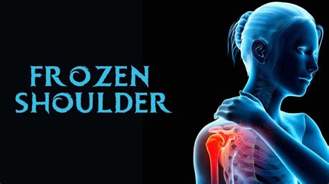 Frozen Shoulder and Diabetes | DiabetesMine