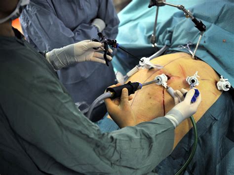 Gastric surgery: Is it really the answer to the UK's obesity epidemic? | The Independent | The ...