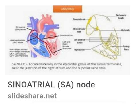 Sinus Node Dysfunction