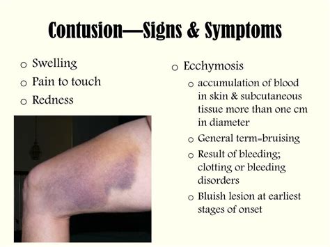 PPT - Skin Wounds Classification PowerPoint Presentation, free download - ID:853573