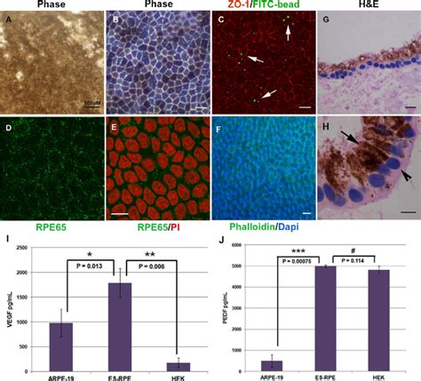 Expression of RPE markers. Morphology of enriched sheets of mature RPE... | Download Scientific ...