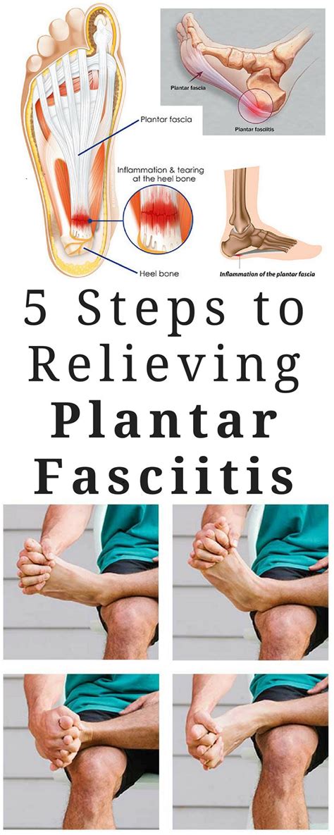 1605 best Plantar Fasciitis Stretches images on Pinterest | Plantar fasciitis, Circular motion ...