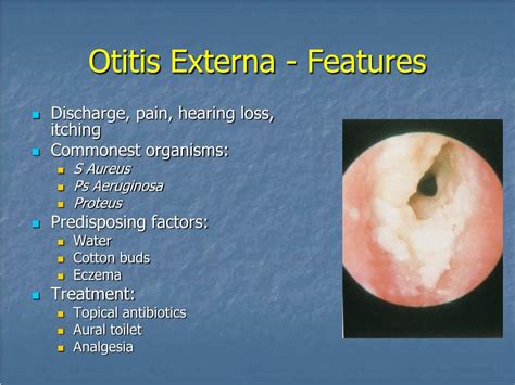 Otitis Externa Causes