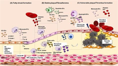 EV signalling in vascular inflammation and atherosclerosis. Brief... | Download Scientific Diagram