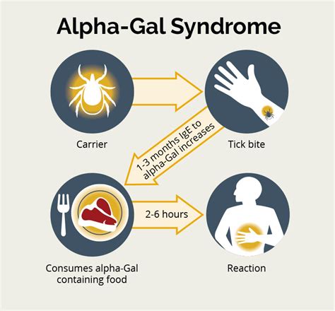 Alpha-Gal Syndrome and Meat Allergy | Allergy & Asthma Network