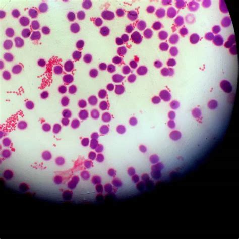 Salmonella Under Microscope - img-Abigail