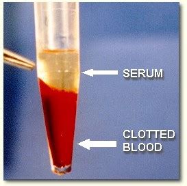 Glossary: Blood serum