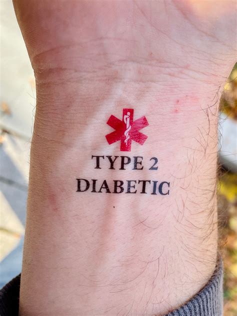 Type 2 Diabetic Medical Alert Temporary Tattoo - Etsy