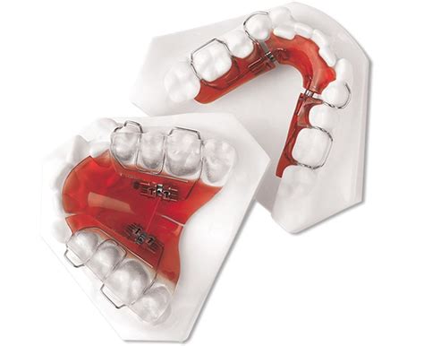 3 Way Expander – BM Ortho Appliances Inc.