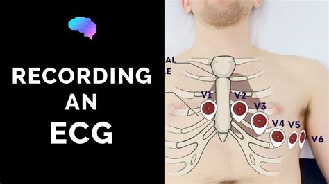 How to record an ECG - OSCE Guide | UKMLA | CPSA - YouTube