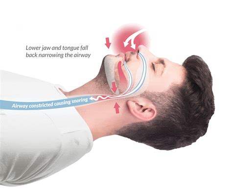 In this article we explore exactly how a stop snoring mouthpiece works, and which one is the ...