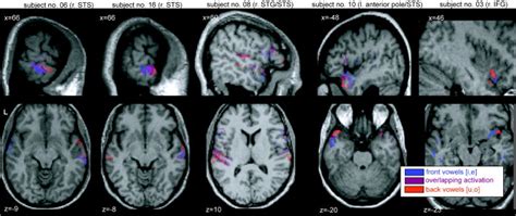 Single-subject activations to Back vowels [u,o] (red), Front vowels ...