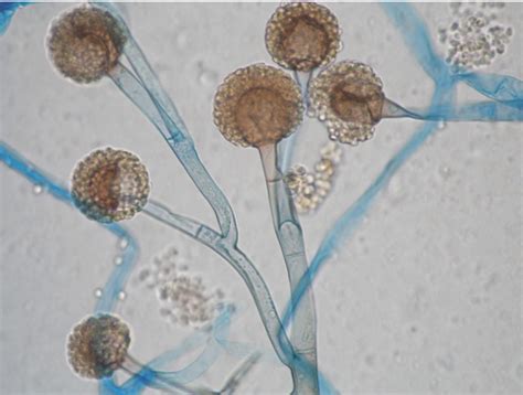 Mucor And Rhizopus