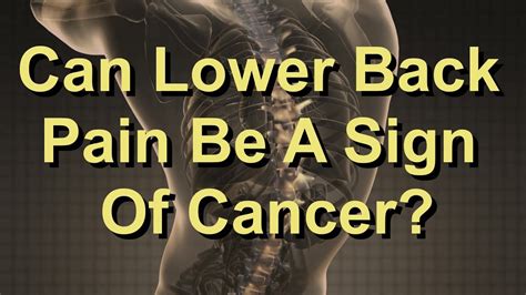 Can Lower Back Pain Be A Sign Of Cancer? - YouTube