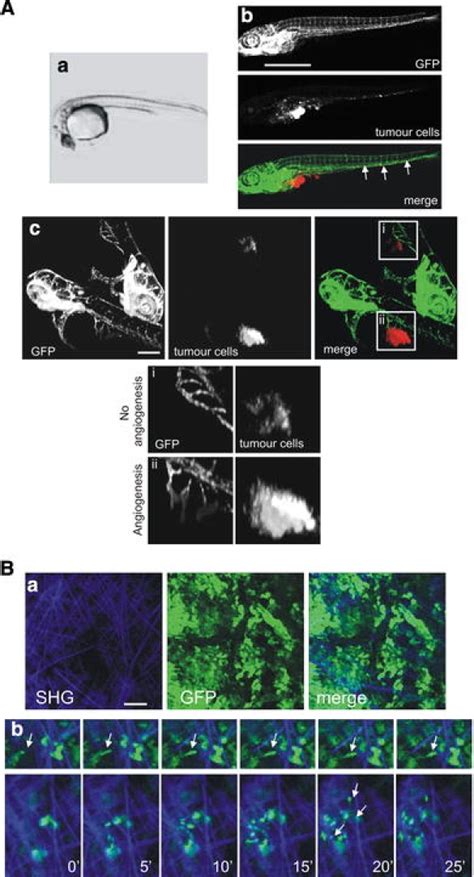 Imaging tumour cell migration in vivo. a Migration and cell mass ...