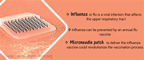 Microneedle Patch to Deliver Influenza Vaccine – A Peek into the Future?