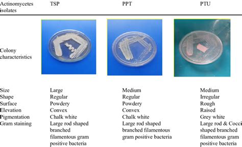 Morphological characterization of actinomycetes | Download Scientific ...