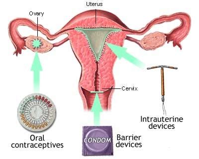 Natural Methods of Contraception