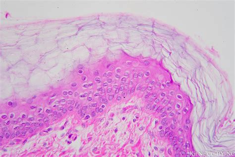 Keratinized Stratified Squamous Epithelium Histology | My XXX Hot Girl