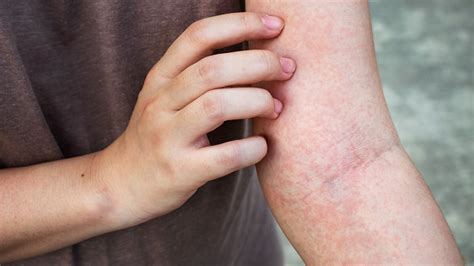 Itching: What’s Causing Your Itchy Skin? (with Pictures)