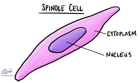 Spindle cells | MyPathologyReport.ca