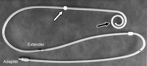 Interventional Radiology Placement and Management of Tunneled Peritoneal Dialysis Catheters: A ...