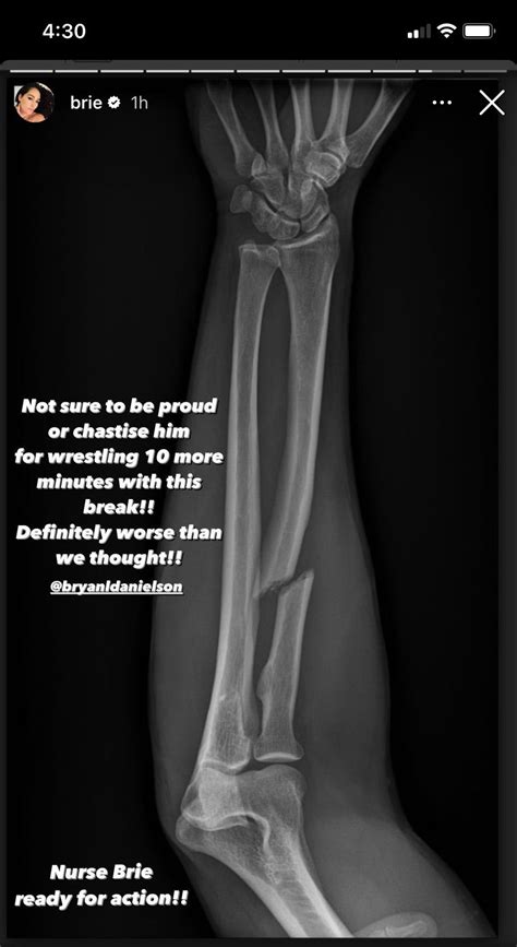 PHOTO: Bryan Danielson's Forbidden Door Injury 'Worse Than Thought' - WrestleTalk