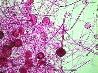 Rhizopus stolonifer- Black Bread Mold Reproduction