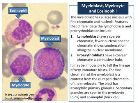 Myelocyte Vs Promyelocyte | Hematology, Morphology, Medical laboratory science