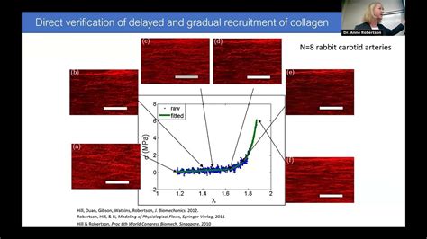 Unraveling the Mechanics of Biological Soft Tissue Using Advanced ...