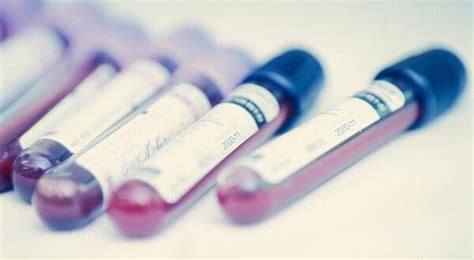 Paraproteinemia Definition, Symptoms, Causes, Treatment