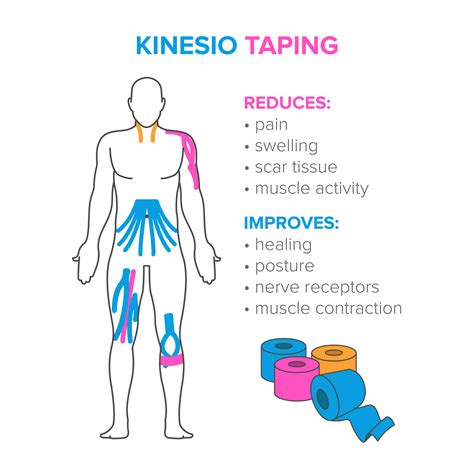 What is kinesiology taping and who does it help?