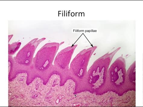 Fungiform Papillae Labeled Tongue Diagram : Dental Anatomy Unit 2 ...