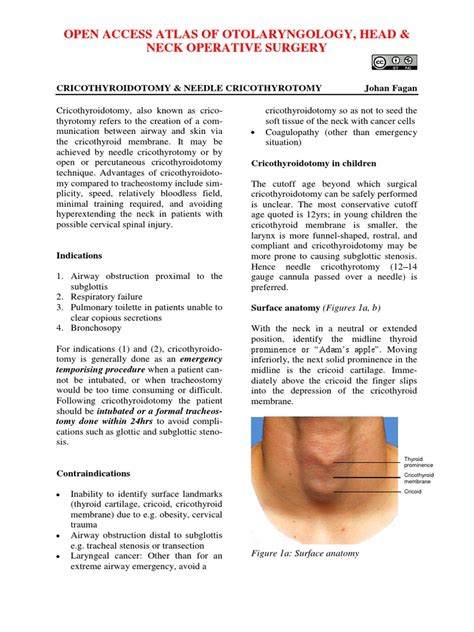 Cricothyroidotomy and Needle Cricothyrotomy | Respiratory Tract | Larynx