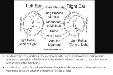 Tympanic Membrane - At the centre of the concavity the deepest point is ...