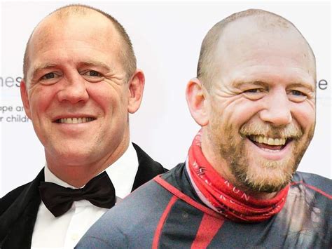 What Happened To Mike Tindall Nose? Surgery Before And After