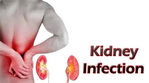 Kidney Infection - Signs, Symptoms, Causes, Treatment, Home Remedies