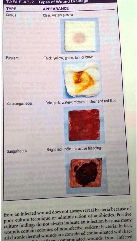 Clear Wound Drainage Is Described as