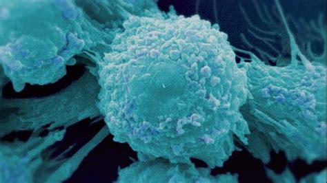 Why is Cancer So Difficult to Cure? | Cancer: The Emperor of All Maladies | PBS LearningMedia