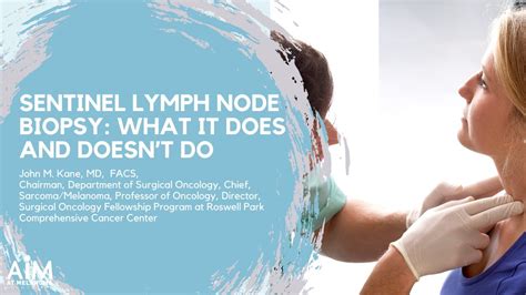 Sentinel lymph node biopsy groin - profwery