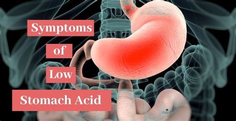 Low Stomach Acid Symptoms and Signs to Watch out for - Root Nutrition ...