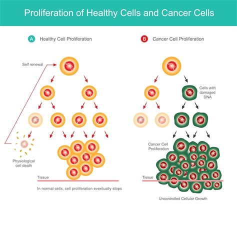 Proliferación de células sanas y células cancerosas. ilustración comparativa de la proliferación ...